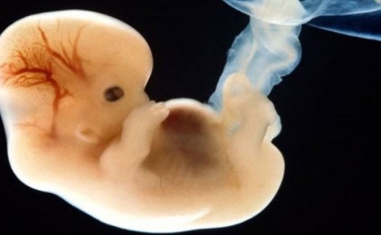 İnsan və donuzun embrionları birləşdirildi