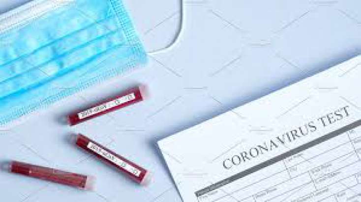 Azərbaycana koronavirusa qarşı testlər gətirilə bilər - 