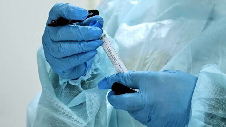 SON DƏQİQƏ: Azərbaycanda 1 nəfər koronavirusdan öldü - 