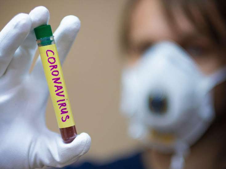 Türkiyədə 108 nəfər koronavirusdan öldü