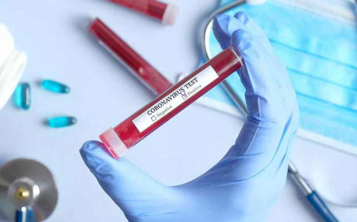 Azərbaycanda daha 76 nəfərdə  koronavirus aşkarlandı,1 nəfər öldü - 