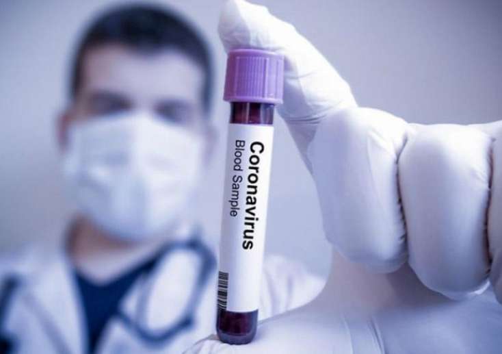 Britaniyada bir gündə 813 nəfər koronavirusdan öldü