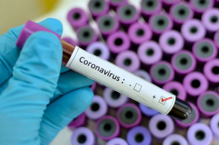 Koronavirusdan ölənlərin sayı 216 mini keçdi - 