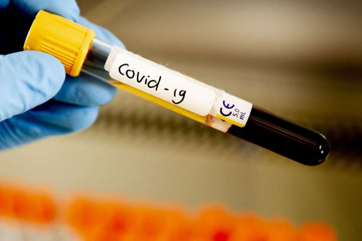 Tacikistanda koronavirusa ilk yoluxma halı aşkarlandı