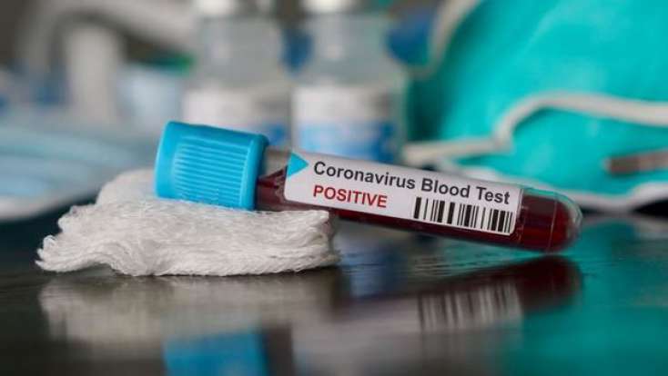 Bakıya gətirilən daha 29 azərbaycanlıda koronavirus aşkarlandı - 