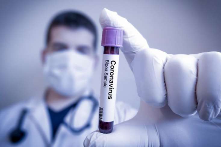 Rusiyada koronavirusa yoluxanların sayı yarım milyonu ötdü