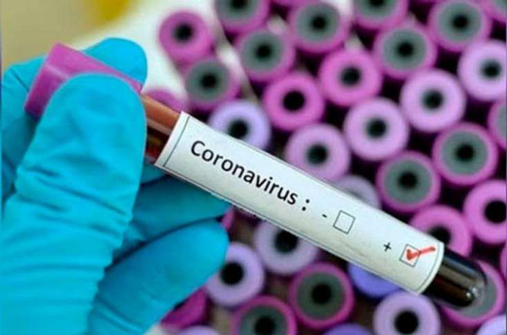 ABŞ-da bir gündə 30 minə yaxın insan koronavirusa yoluxdu