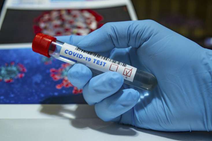İranda son sutkada koronavirusdan 125 nəfər öldü
