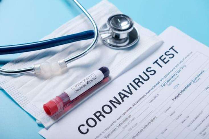 Türkiyədə daha 1293 nəfər koronavirusa yoluxdu
