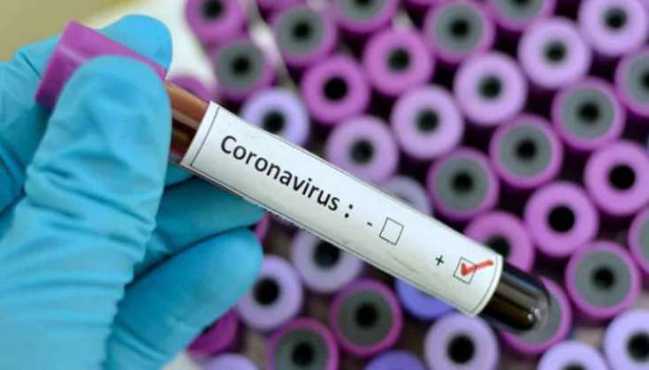 SON DƏQİQƏ: Azərbaycanda koronavirusa yoluxanlar 