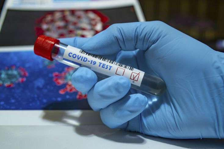 Azərbaycanda ümumilikdə 759 129 koronavirus testi aparılıb