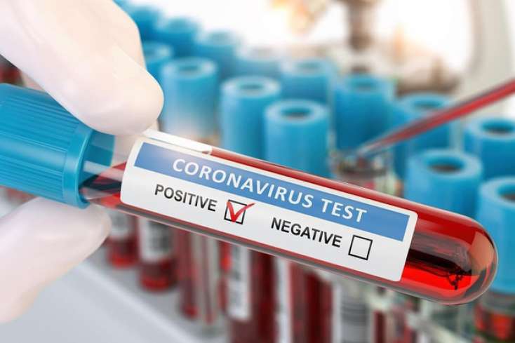Azərbaycanda ümumilikdə 812 033 koronavirus testi aparılıb