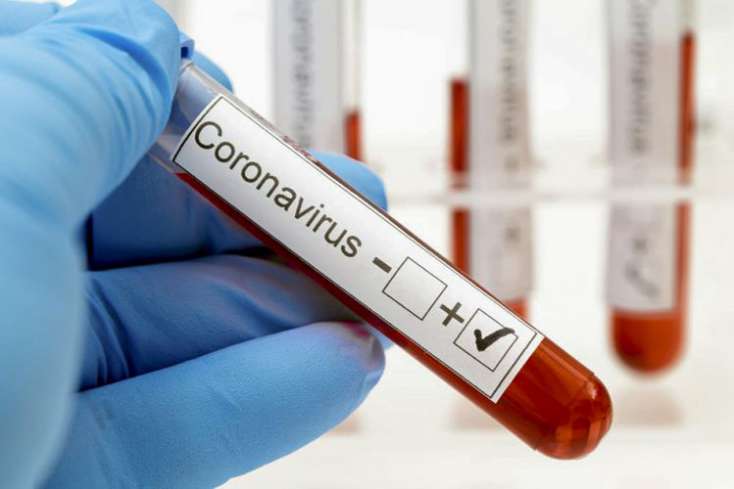 İranda ötən sutka 112 nəfər koronavirusdan öldü