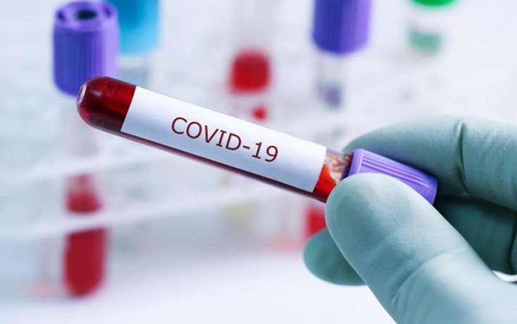 Türkiyədə koronavirusdan daha 39 nəfər ölüb