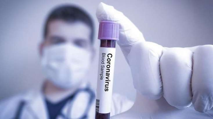Ermənistanda daha 124 nəfər koronavirusa yoluxub