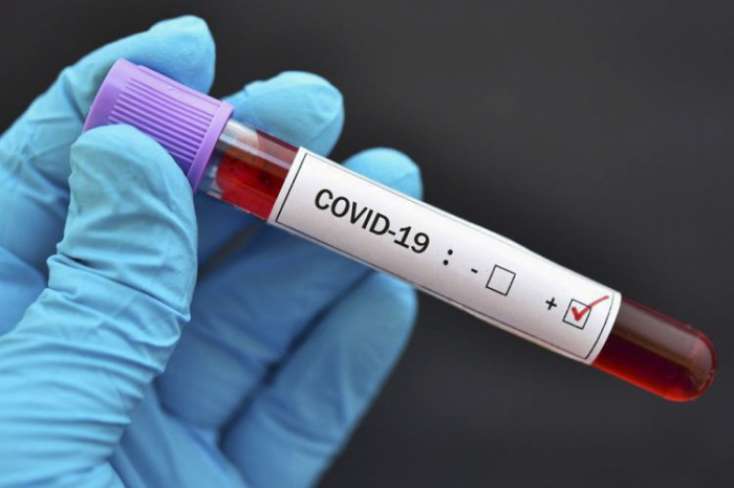 Türkiyədə son sutkada koronavirusdan 53 nəfər öldü