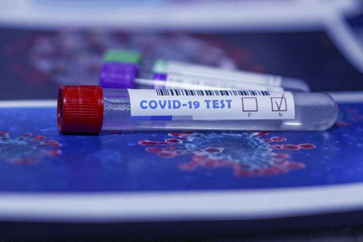 Azərbaycanda indiyədək 1020029 koronavirus testi aparılıb