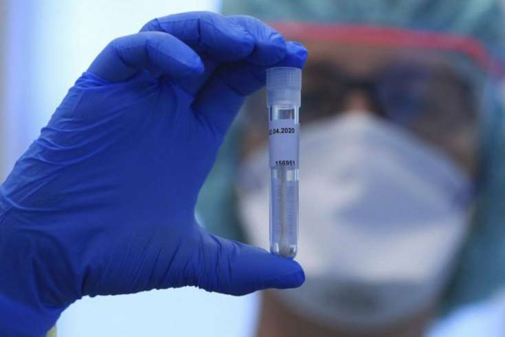 İranda ötən sutkada koronavirusdan 482 nəfər öldü