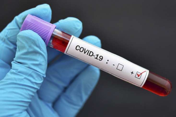 İranda koronavirusa yoluxanların sayı 962 min keçdi