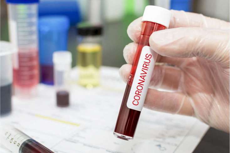 Rusiyada koronavirusa yoluxanların sayı 2,5 milyon nəfəri ötüb