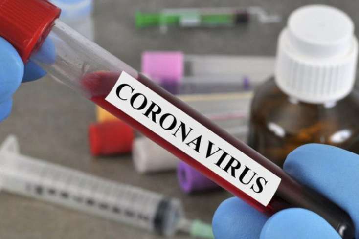 Rusiyada koronavirusdan ölənlərin sayı 59 mini ötüb