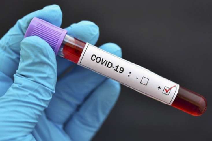 İranda ötən sutkada koronavirusdan 98 nəfər ölüb