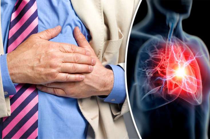 Ürək-damar xəstəliklərinin inkişafına nələr səbəb olur? -