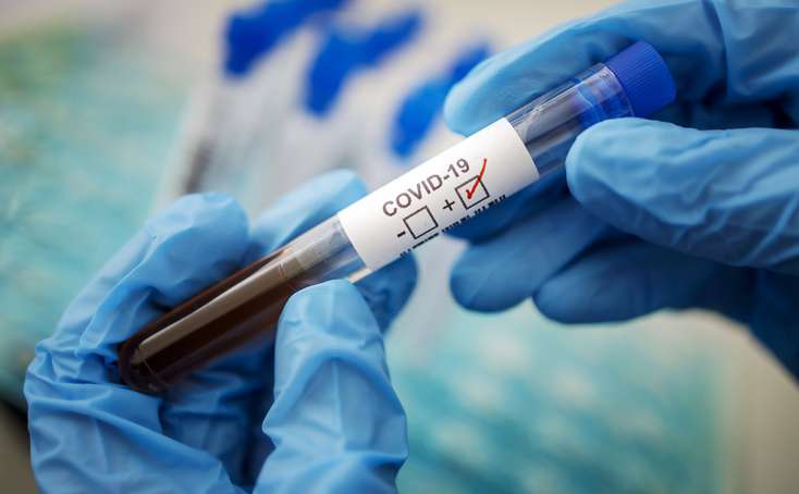 Azərbaycanda son sutkada daha 21 nəfər koronavirusa yoluxub