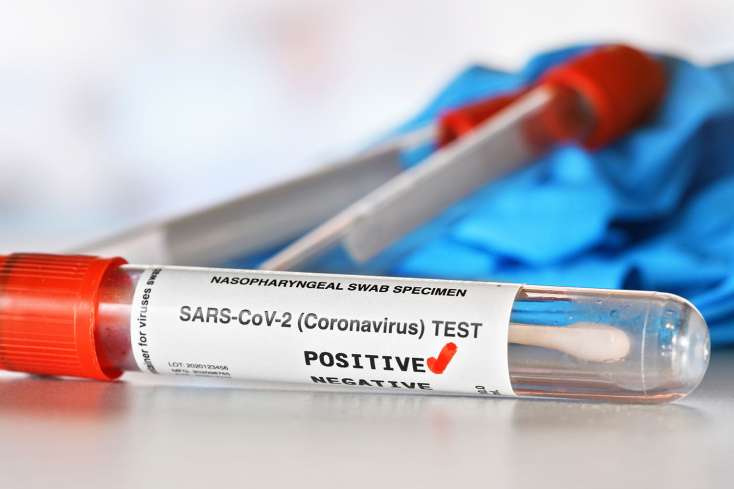 Azərbaycanda koronovirusa görə aparılan testlərin sayı 7 milyonu ötüb