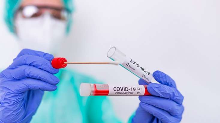Hansı test üsulu koronavirusun nəticəsində daha effektlidir? - 