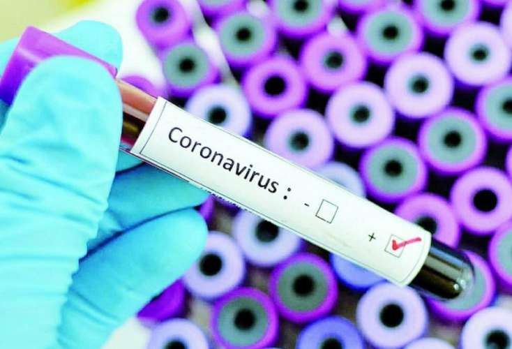 Son sutkada koronavirusa yoluxanların 