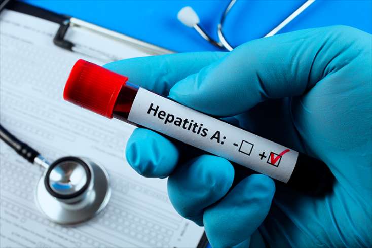 Hepatit A-ya yoluxan uşaqlarıın yaş qrupu açıqlandı - 