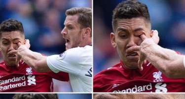 "Liverpool"un hücumçusu gözündən zədələndi