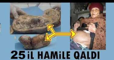 25 il hamilə qalan qadın - 