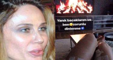 Məşhur modelin ayağı yandı -