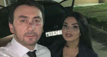 İranlılar Aqşinin 2 milyonluq klipini sildirdi - 