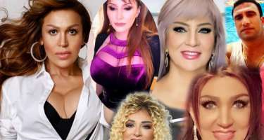 "Fotoşop"un ağını çıxarıb, biabır olan məşhurlarımız - 