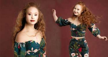 İlk daun sindromlu model görənləri heyrətləndirir -