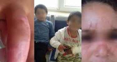 Bakıda uşaqlar ögey anaları tərəfindən döyülüb? - 