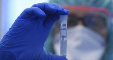 Azərbaycanda indiyədək 922069 koronavirus testi aparılıb