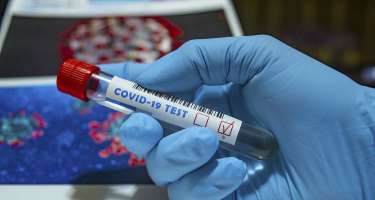 Azərbaycanda ümumilikdə 935 396 koronavirus testi aparılıb