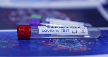 Azərbaycanda indiyədək 1020029 koronavirus testi aparılıb