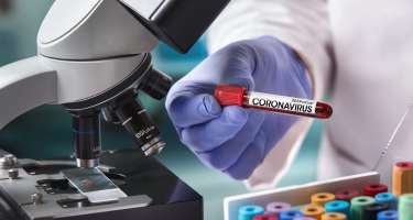 SON DƏQİQƏ: Azərbaycanın "Xalq artisti"nə koronavirus şoku