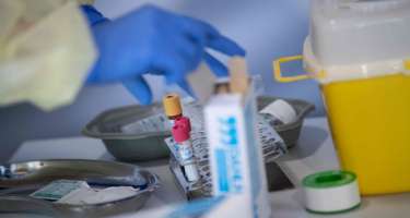 Buzlu şüşə diaqnozu qoyulan koronavirus xəstələri nə etməlidir? - 