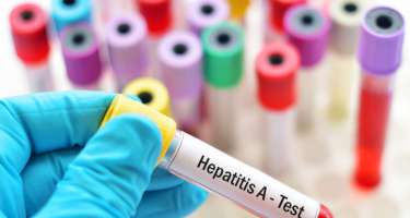 Ötən il Azərbaycanda hepatit xəstəliyindən ölənlərin sayı  60-ı keçib