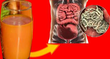 Qurddan xilas üçün təbii yollar - 