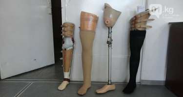 Vətən müharibəsində xəsarət alan 200 hərbçi protezlərlə təmin edilib