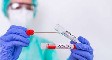 Hansı test üsulu koronavirusun nəticəsində daha effektlidir? - 