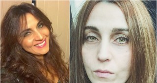Azərbaycanlı müğənni tanınmaz hala düşdü...