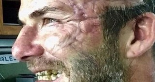 Devid Bekxem tanınmaz hala düşdü